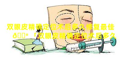 双眼皮精确定位术后多久修复最佳 💮 「双眼皮精确定位术后多久修复最佳手术期」